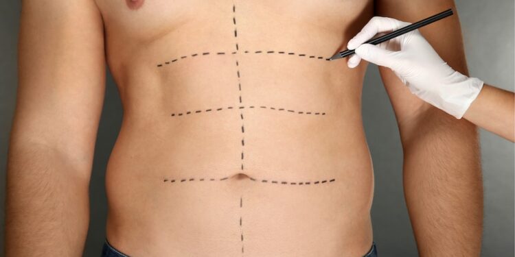 Understanding Surgical Options for Enhancing Body Proportions