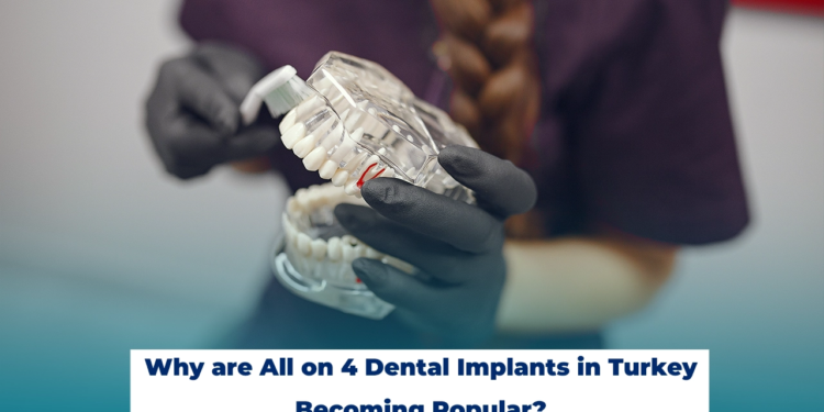 All on 4 Dental Implants in Turkey